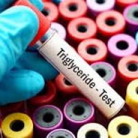 Trigliceridos. 903868  Idime (2022)