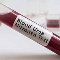 Nitrogeno ureico, BUN. 903856  Idime (2022)