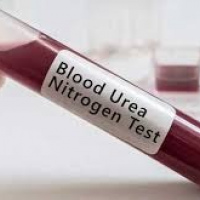 Urea en sangre. 903869 Idime (2022)