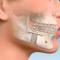 Consulta de cirugia maxilofacial . Instituto Roosevelt (2022)
