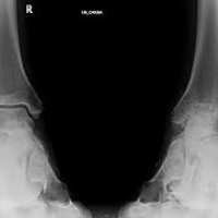 Radiografia de tobillo AP, lateral y rotación interna.873431 Idime