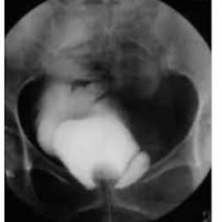 Gamagrafia de residuo vesical. 920804 Idime (2024)