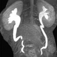Resonancia nuclear magnetica de vias urinarias (urorresonancia) simple y contrastada. EN, codigo 883435 SC (2022)