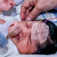 Potenciales evocados auditivos de corta latencia con curva funcion intensidad-latencia.  954629. Audiosalud (2022)