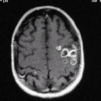 Resonancia nuclear magnetica cerebral funcional (motora, auditiva y visual) contrastada. EN. Codigo CUPS 883104 C (2022)