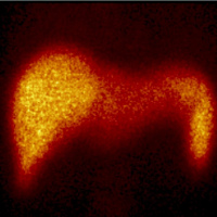 Gamagrafia esplenica.920501  Idime (2024)