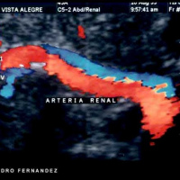 Duplex de vasos del pene a color. 882272 Idime