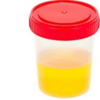 Acido urico en orina parcial. 903877. Idime