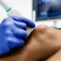 Ecografia articular. Ecografias Bogota (Mandalay)