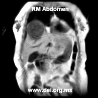 Resonancia nuclear magnetica de abdomen. EN. Codigo 883401 (2022)