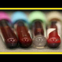 Fosfatasa alcalina.903833 Idime. (2022)