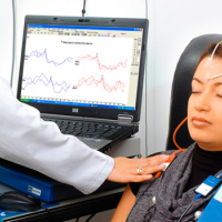 Potenciales evocados auditivos de corta latencia por via osea. 954628. Audiosalud. (2022)