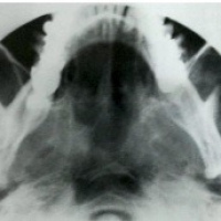 Radiografia de mastoides comparativas. 870005Idime