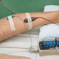 Electromiografia por extremidad. Instituto Roosevelt. (2022)