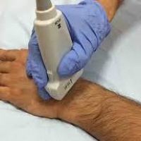 Ecografia articular de mano. 881613. Idime