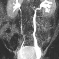 Resonancia nuclear magnetica de vias urinarias (urorresonancia).883435 Idime
