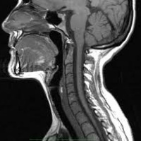 Resonancia nuclear magnetica de cuello con contraste. 883111. Idime