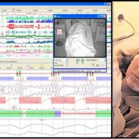 Pruebas de latencia multiple de sueño. 891801 Idime (2024)