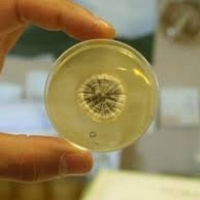 Cultivo de hongos (incluye KOH). 901213. Idime (2022)