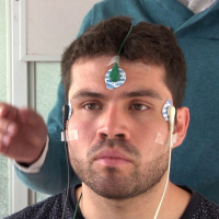 Electronistagmografia [ENG] o fotoelectronistagmografia . 954402. Audiosalud (2022)