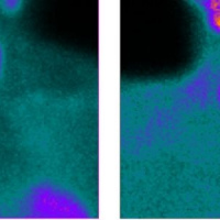 Gamagrafia de glandulas paratiroides. 920208 Idime (2024)