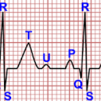 Electrocardiograma de ritmo o de superficie SOD. 895100 - 890105  Idime