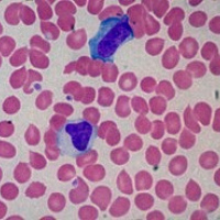 Anticuerpos heterofilos 906903  Idime. (2022)