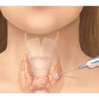 Biopsia de glandula tiroides via percutanea, aguja fina. 61002 Idime (2024)