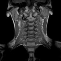 Resonancia nuclear magnetica de cuello.883111 Idime. (2022)