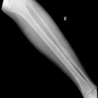 Radiografia de huesos largos serie completa. Esqueleto axial y apendicular 873002 Idime
