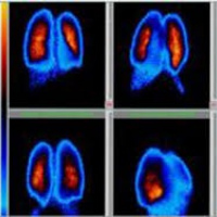 Gamagrafia de perfusion testicular y contenido escrotal. 920806 Idime (2024)