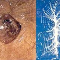 Trombectomia anal. Uniendoscopia (2023)