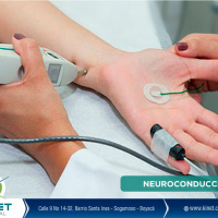 neuroconduccion por extremidad. Instituto Roosevelt. (2022)
