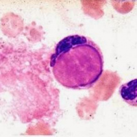 Celulas LE. 902101 Idime. (2022)