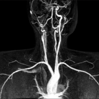 Angiografia de cuello. CUPS 883909. Idime (2022)