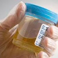 Urea en orina. 903869 Idime (2022)