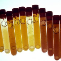 Bilirrubinas diferenciadas. 903809  Idime. (2022)