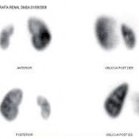 Cistogamagrafia.920807 Idime (2024)