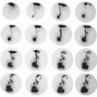 Salivograma (test de broncoaspiracion) . 920307 Idime (2024)