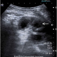Ecografia de torax. Ecografias Bogota (Ilarco)
