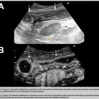 Ecografia pelvica con analisis doppler. 881360. Idime