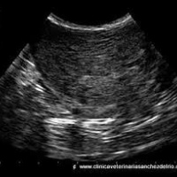 Ecografia de testiculos (contenido escrotal). Ecografias Bogota (Mandalay)