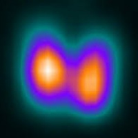 Gamagrafia de tiroides.920202 Idime (2024)