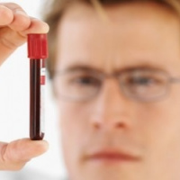 Prueba de O´Sullivan presuntiva dos muestras. 903845  Idime (2022)