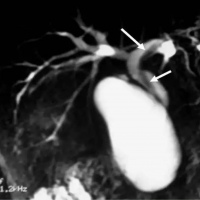 Colangiorresonancia simple. 883434 Idime (2022)