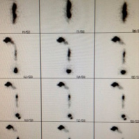 Gamagrafia de transito esofagico. 920605 Idime (2024)