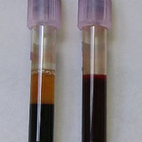 Colesterol de alta densidad HDL. 903815  Idime. (2022)