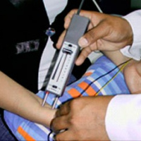 Electromiografia. Prueba estimulo repetitivo (Lambert). 891511 Idime