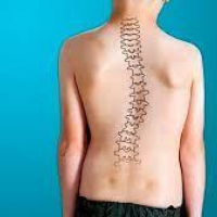 Consulta de ortopedia y traumatologia pediatrica - ortopedia de columna. Instituto Roosevelt. (2022)